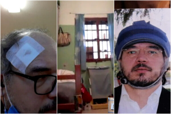 Vive in 2 metri di spazio tra crisi epilettiche, il dramma di Ezio: “Sbatte ovunque, bagno più grande della cella”