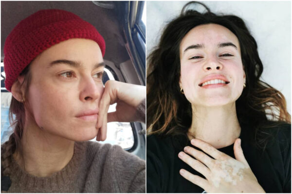 La malattia di Kasia Smutniak, l’attrice contro il clickbait: “Cari giornali, sto da Dio”