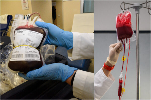 Bimbo deve essere operato, genitori rifiutano trasfusioni dai vaccinati: “Vogliamo solo sangue no Vax”