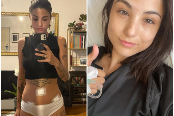 Cos’è l’endometriosi: sintomi, cura e diagnosi della sindrome da “ciclo doloroso” raccontata da Giorgia Soleri