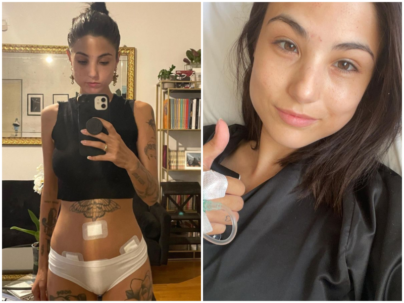 Cos’è l’endometriosi: sintomi, cura e diagnosi della sindrome da “ciclo doloroso” raccontata da Giorgia Soleri