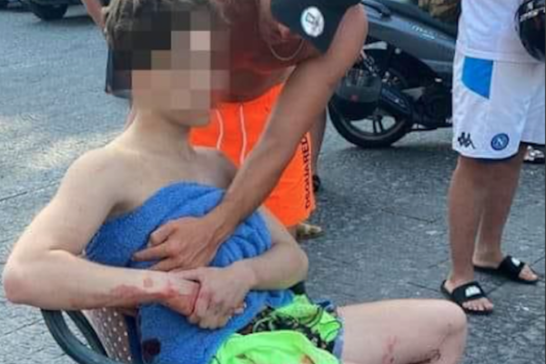 Luigi e Antonio fuori pericolo dopo le coltellate a Marechiaro, la mamma: “Mio figlio è stato sventrato”