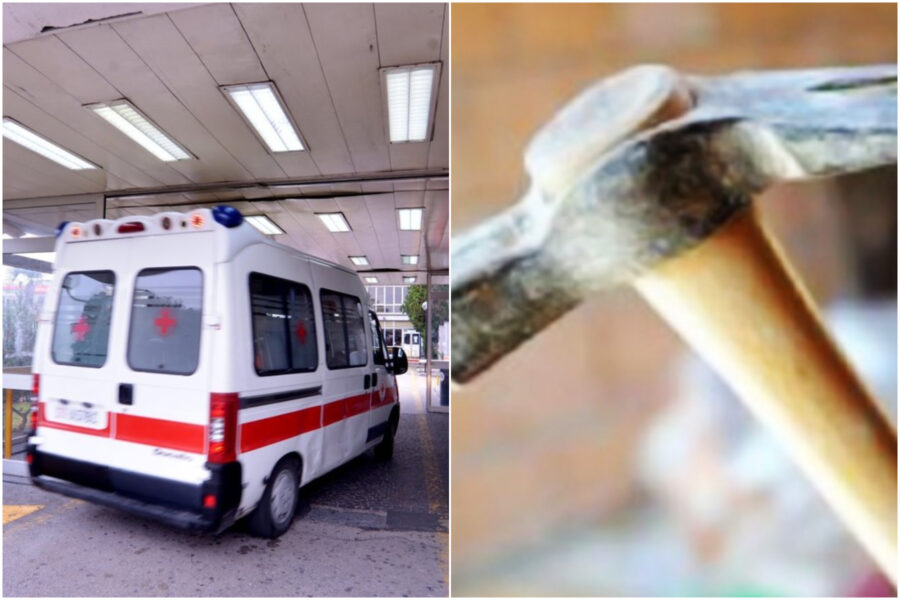 Martellate alla testa e coltellate al ventre, giovane salvato dai medici del Cardarelli: fermati due coetanei