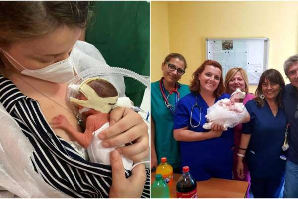 Nasce a 23 settimane di gestazione e pesa 600 grammi, il parto da record: “Il piccolo sta bene”
