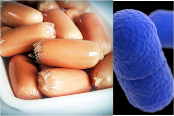 Cos’è la listeria, i sintomi e la cura: il caso delle 3 morti sospette e il ritiro dei wrustel contaminati dai supermercati