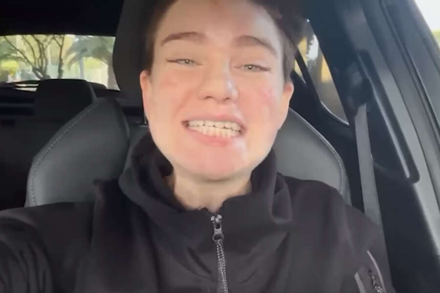 Bebe Vio rompe il silenzio: “Ho affrontato un periodo bello tosto, ma sto tornando”