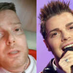 Pasqualino Maione lotta contro la meningite, dopo mesi torna su TikTok: “Non sono ingrassato”