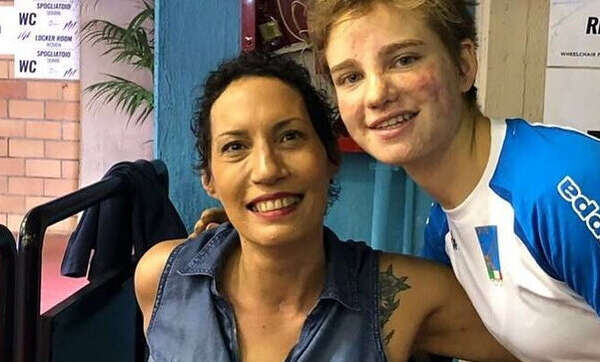 Le amputano gambe e braccia per un tumore, ma la diagnosi era sbagliata: Bebe Vio la aiuta con le protesi