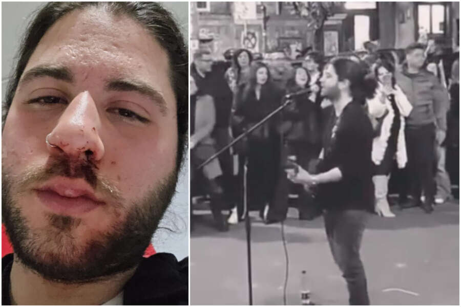 Esibizione bocciata, chitarrista picchiato in piazza Bellini da proprietario locale: “Scostumato, sapete dove sto”