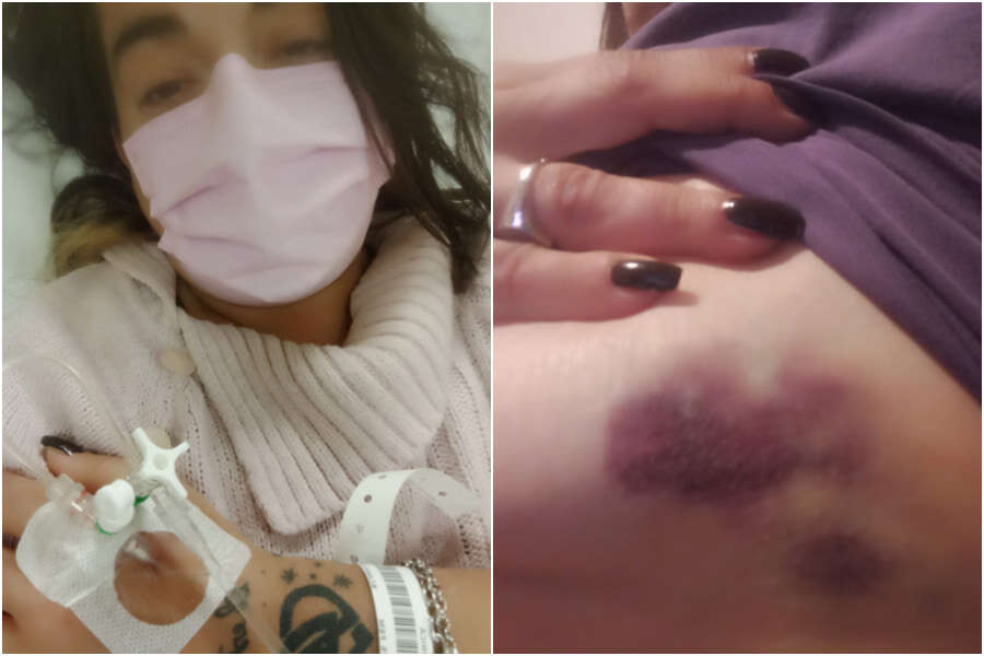 Picchiata da 5 uomini per difendere l’amica, il dolore di Monica: “Nessuno ci ha aiutate, più delle botte mi fa male l’indifferenza”
