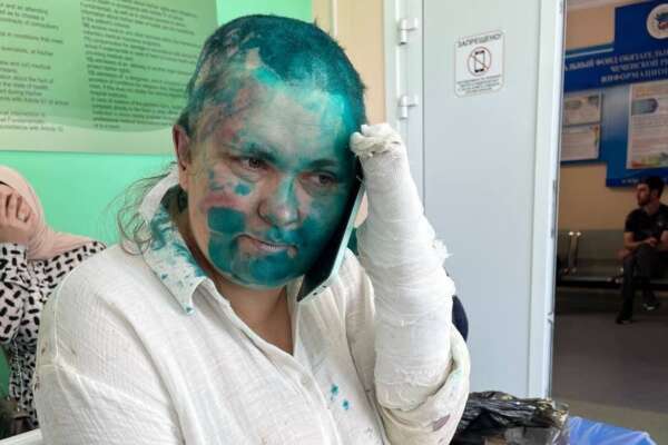 Giornalista russa Elena Milashina picchiata in Cecenia: dita spezzate, sul corpo liquido tossico (già usato con Navalny). Il ‘dispiacere’ del Cremlino