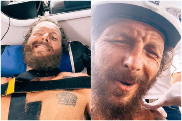 Jovanotti cade dalla bici a Santo Domingo: “Male bestiale, mi sono rotto”