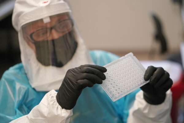 Vaiolo delle scimmie, a Genova un nuovo positivo: febbre alta ed eruzioni cutanee Vaiolo delle scimmie, a Genova un nuovo positivo: febbre alta ed eruzioni cutanee