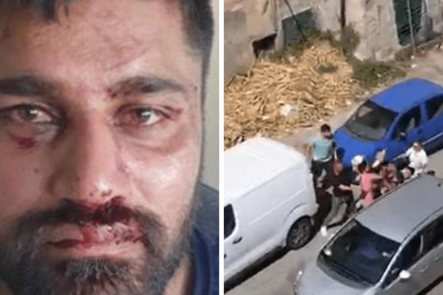 Roma, violento pestaggio di uno scippatore al Quarticciolo. Fra gli aggressori una donna del posto. La vittima: “Pronto a denunciare”