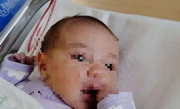 meningite batterica meningite batterica