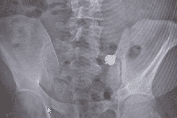 auricolare patente polizia