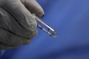 Dengue, primi sintomi e diagnosi del virus: quando bisogna preoccuparsi per la puntura di una zanzara e perché è meglio non uccidere quelle gonfie di sangue