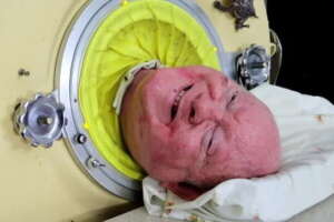 Paul Alexander, morto l’uomo che ha vissuto 70 anni in un polmone d’acciaio: sopravvissuto a un’epidemia di poliomielite