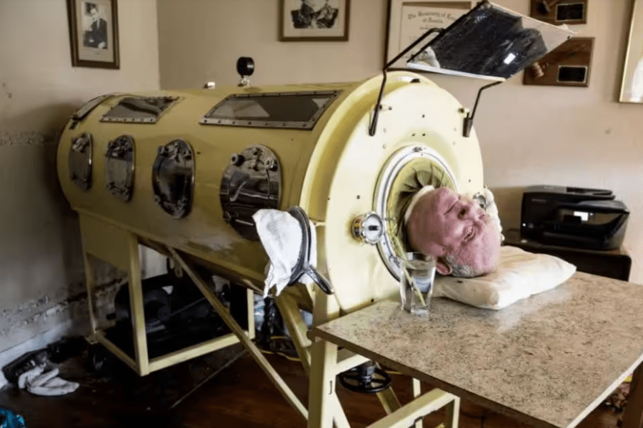 Polmone d’acciaio, come funziona e cos’è la prima protesi respiratoria legata ai casi gravi di poliomielite: Paul Alexander ci ha vissuto per 70 anni