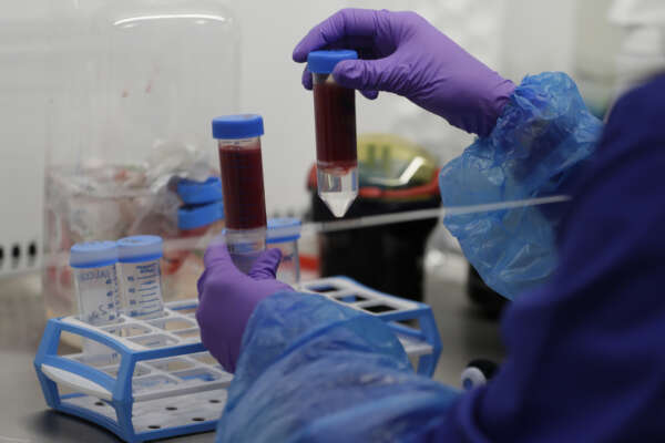 Donazione e trapianti di organi