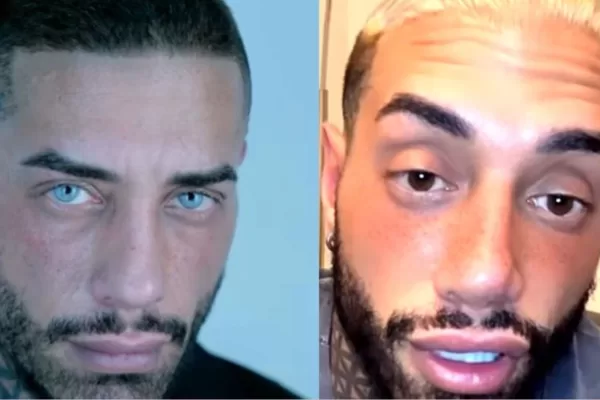 Francesco Chiofalo, primo vero problema dopo il cambio di colore degli occhi: “Non ci vedo bene”. I soccorsi a casa e l’arrivo in ospedale