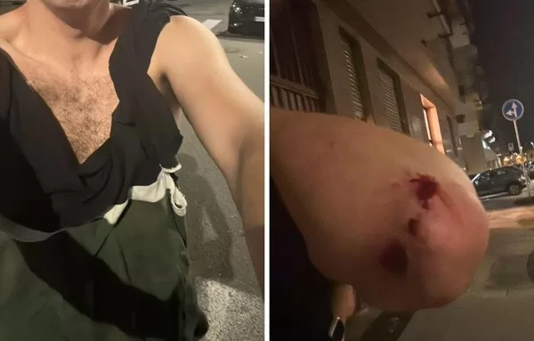 Andrea Joly, giornalista aggredito