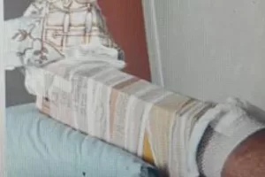 Ingessato con del cartone all’ospedale di Patti e rimandato a casa, “stecche finite”. Elia Natoli: “Avevo troppo dolore”. Le scuse di Schifani