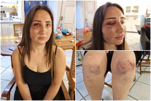 Gaia sopravvissuta al massacro dell’ex: il blitz in strada, il ruolo dei due amici, il miracolo del belvedere e il cellulare salvavita