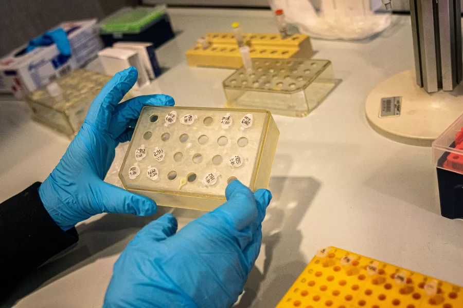 15 Dicembre  2022 Milano, Italia 
Inaugurazione  per l’avvio della nuova Struttura Complessa di Genetica Medica dell’ASST Santi Paolo e Carlo realizzata in collaborazione con l’Università degli Studi di Milano
Ermes Beltrami/LaPresse