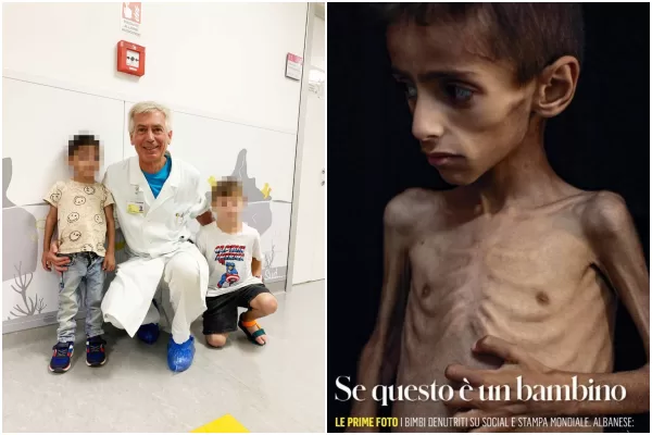 Gaza, il dottore italiano che ha curato il piccolo Osama: “Ha una malattia genetica rara. La mamma e il fratello non erano denutriti” Gaza, il dottore italiano che ha curato il piccolo Osama: “Ha una malattia genetica rara. La mamma e il fratello non erano denutriti”