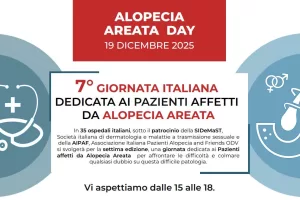 Alopecia Areata Day, il 19 dicembre consulenze gratuite alla clinica dermatologica Federico II di Napoli