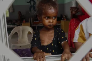 Four-year-old Farhia, who is suffering from severe acute malnutrition, looks through a window at a hospital in Qardho, Puntland, Somalia, Friday, April 17, 2026. (AP Photo/Jack Denton)