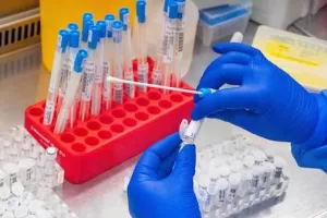 Laboratori biologici finanziati dagli Usa in Ucraina: cosa sappiamo dopo la declassificazione Laboratori biologici finanziati dagli Usa in Ucraina: cosa sappiamo dopo la declassificazione