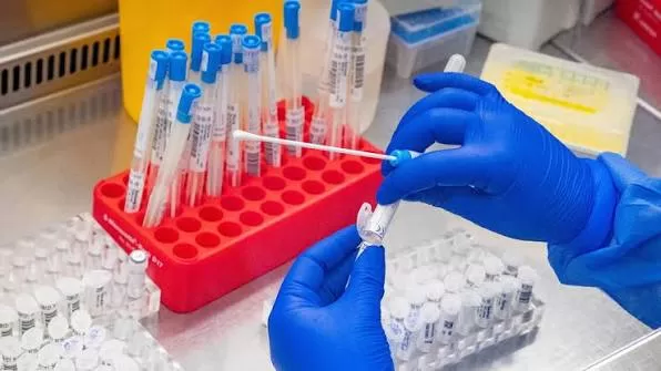 Laboratori biologici finanziati dagli Usa in Ucraina: cosa sappiamo dopo la declassificazione